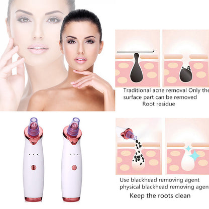 Acne Vacuum Suction Blackhead Remover Skin Care Tool